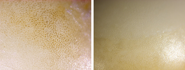 Figure 2. Left: Cellular calcite structure; field of view 0.5 mm. Right: Aragonite platy surface structure; field of view 0.8 mm. Photomicrographs by Pfokreni Nipuni.
