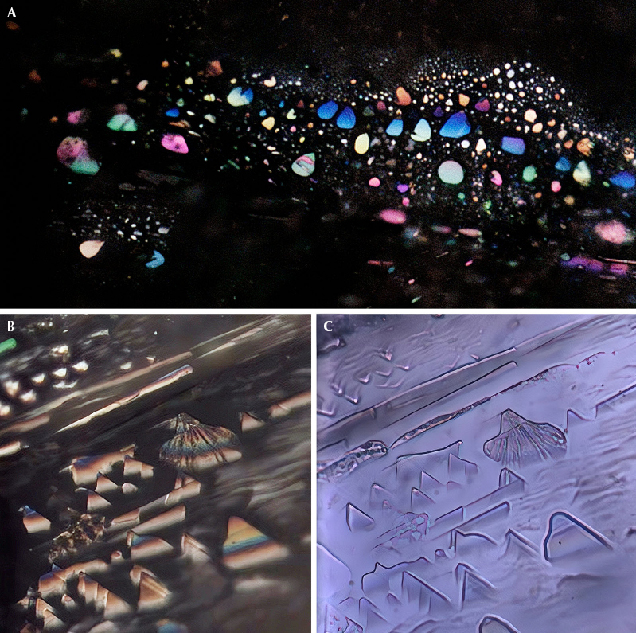 Figure 2. Inclusions along the white arms of trapiche-like sapphire. A: Thin-film inclusions display colorful interference colors under reflected light. B: Triangle-shaped fissures, which are perpendicular to the crystallographic c-axis, resemble overlapping hills, including a volcano just right of center. These fissures show spectral interference colors under reflected light. C: In transmitted light, the pattern of inclusions resembles a Chinese landscape painting with a volcano in it. Photomicrographs by Xiaojing Lai; fields of view 0.30 mm (A) and 0.15 mm (B and C).