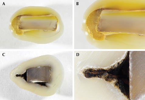 Cross sections of two “box bead” cultured pearl samples.