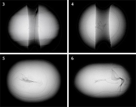 Figure 4. The internal structures of four of the pearls showed twisted void-like features surrounded by fine growth arcs characteristic of non-bead cultured freshwater pearls. The two wide vertical gray features seen in pearls 3 and 4 are the drill holes.