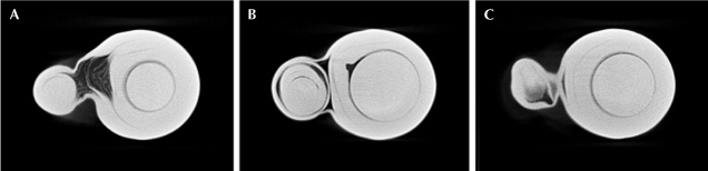 Figure 4. μ-CT scan images of the saltwater bead cultured pearl at different depths.