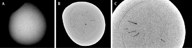 Figure 2. A: RTX image revealing a unique acicular “lily pad” feature with tiny flame-like structures. B: μ-CT scan displaying a small central core with elongated spiky features. C: A magnified μ-CT scan showing the spiky features surrounded by prominent growth arcs.