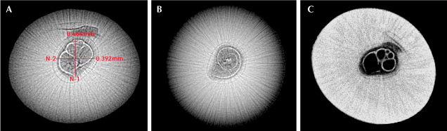 Figure 3. A: RTX image showing the measurements of the foraminifera shell at the center surrounded by an acicular structure. B: RTX image of the pearl along its length, revealing the spiral top formation of the foraminifera shell. C: μ-CT image of the foraminifera shell and acicular structure.