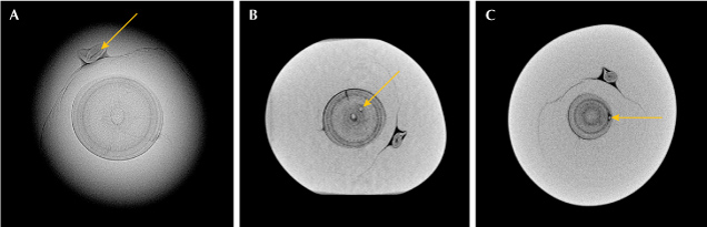 Figure 2. A: RTX image showing an oval core in an organic-rich concentric structure surrounded by an acicular pattern. An elongated, irregular Tokki-like feature with a linear structure is positioned on the top of the concentric growth structure. B: μ-CT image showing the oval core with a seed feature on the inner growth arc. C: μ-CT image showing another seed feature on the outer growth arc.