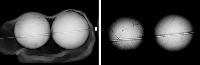 Microradiographs revealed two round bead nuclei (left) and a network of tubules (right). Images by Sharon Tsz Huen Wu.