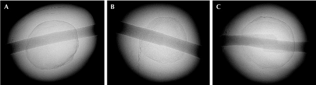 Figure 4. A large dark gray organic-rich area is a typical structure in natural Pteria pearls, and sometimes a faint radial structure is found within the dark area.