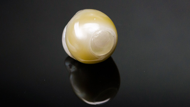 Assembled baroque bead-cultured pearl