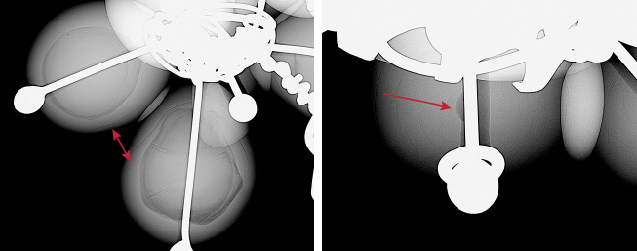 Figure 2. Real-time microradiography of the internal structures observed in the larger nose ring consisting of organic-rich acicular structures and growth arcs (left) and a “collapsed core” near the drill hole area surrounded by growth arcs (right).