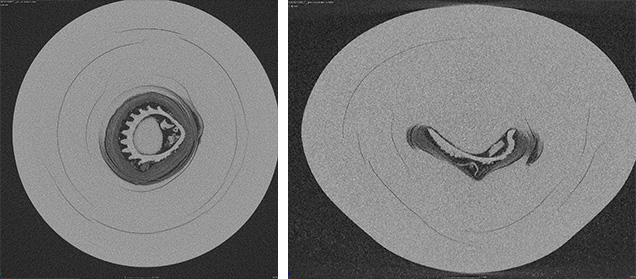 Conventional 2-D μ-CT slices of a pearl