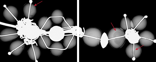 Figure 3. The majority of the pearls in the smaller nose ring showed faint growth arcs and concentric ringed structures, while three of them showed organic-rich acicular cores (marked with arrows) typical of natural pearls.