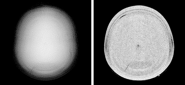 Figure 4. Left: RTX image revealing the calcitic nature of the pearl. Right: μ-CT scans showed a small core with a large acicular structure covering the entire area.