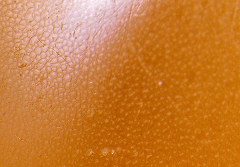 The cellular surface pattern displayed by the non-nacreous pearls.
