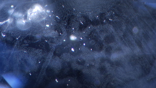 Circular inclusions resembling corkscrews