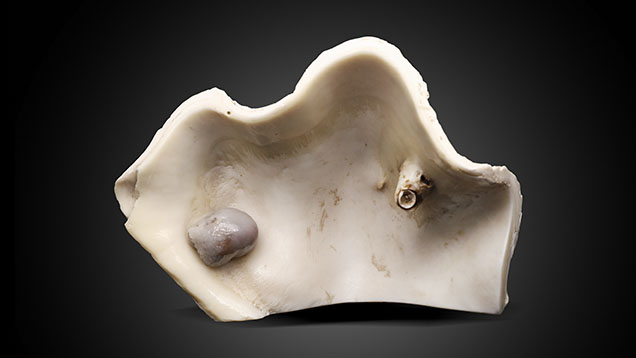 Figure 1. Tridacna shell with a natural blister pearl measuring 37.31 × 25.42 mm (left) and a shell blister measuring 28.93 × 16.63 mm (right). Photo by Gaurav Bera.