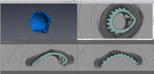 Extraction of the internal structures using 3-D software