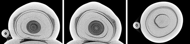 μ-CT slices of cultured pearl μ-CT slices of cultured pearl