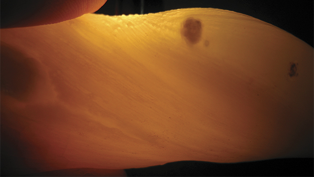 Tridacna Pearl Under Transmitted Light Tridacna Pearl Under Transmitted Light