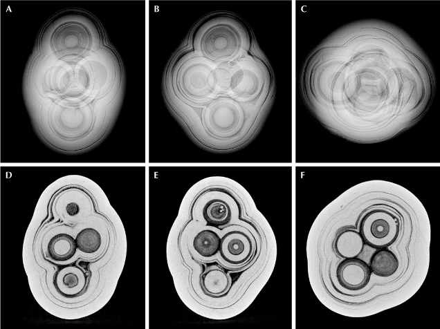 Figure 2. Top: RTX images revealing the pearl’s complex multicore internal structure. Bottom: μ-CT images displaying the six cores present inside the pearl.