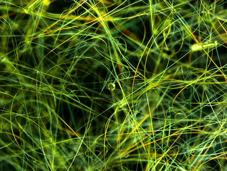 Figure 1. Fibers of serpentine were observed throughout this demantoid garnet in an unusual randomly curved pattern. Photomicrograph by Shunsuke Nagai; field of view 2.00 mm.